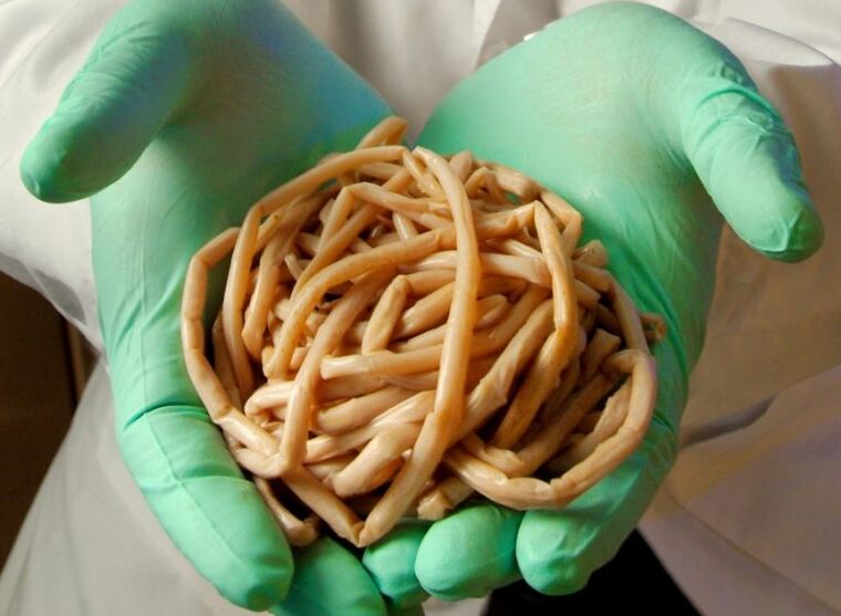 Worms in the human body